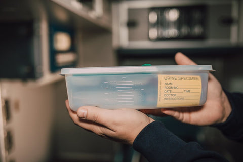 Sample Containers & Urine Pots